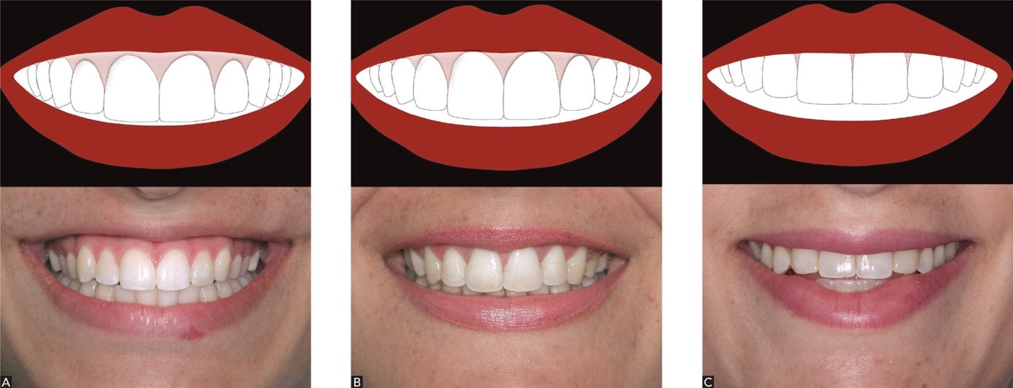 smile-anatomy-grand-oaks-orthodontics