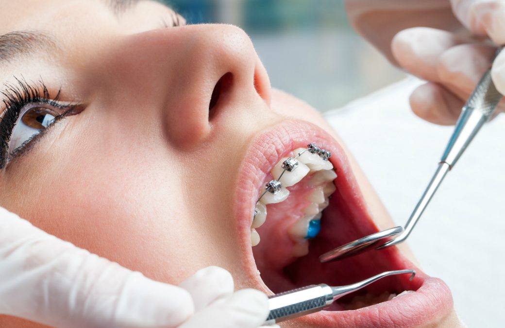 What Benefits Can You Get From Orthodontists
