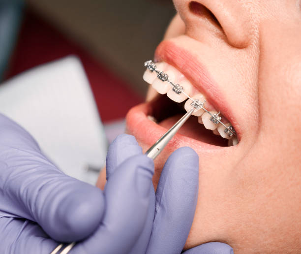 What Benefits Can You Get From Orthodontists