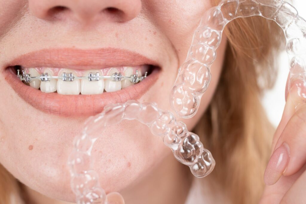 Top 7 Benefits of Choosing Invisalign