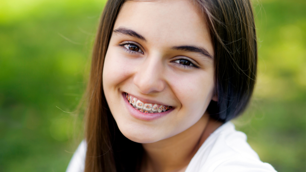 Why Teens and Adults Choose Braces