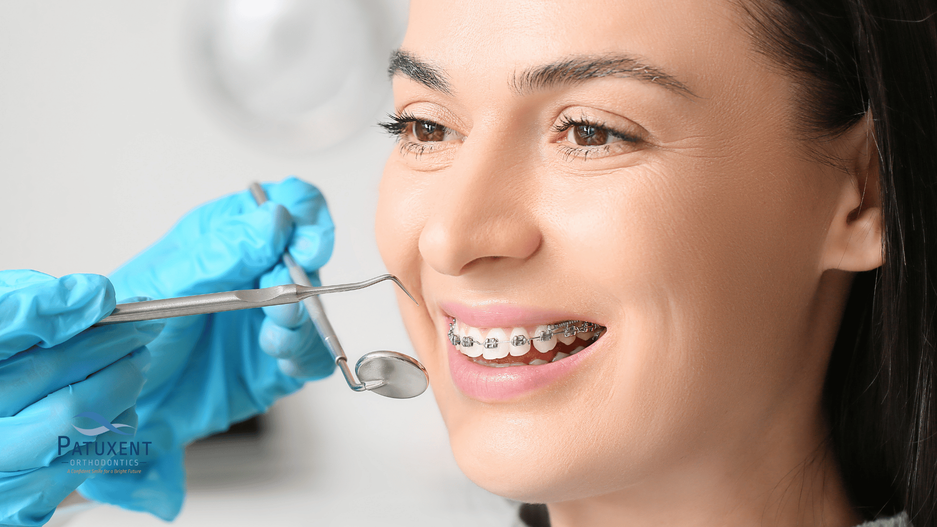 Braces for Teens and Adults: Achieving a Confident Smile at Any Age in Oakville